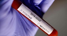 Число зараженных коронавирусом в Узбекистане превысило 1,9 тыс.