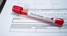 Минздрав Узбекистана сообщил о новых случаях заражения COVID-19