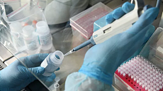 В Узбекистане число случаев заражения COVID-19 превысило 3600