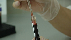 Почти на 30% выросло число новых заражений ВИЧ в Центральной Азии и Восточной Европе в 2018 году