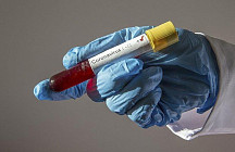 Число заболевших Covid-19 в Узбекистане превысило 2 тыс.