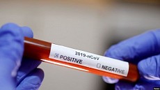 В Узбекистане число зараженных коронавирусом выросло до 33 человек