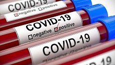 В Узбекистане число случаев коронавируса достигло 2149