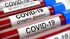 Минздрав Узбекистана сообщил о новых случаях заражения COVID-19