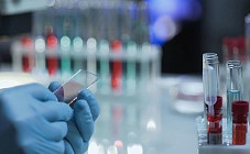 Число случаев коронавируса в Узбекистане приблизилось к 3300