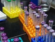 Количество зараженных COVID-19 в Таджикистане достигло 2140