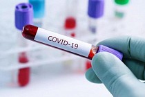 В Узбекистане число случаев COVID-19 достигло 3396