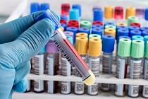 В Узбекистане число случаев заражения COVID-19 превысило 3700