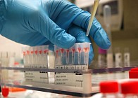 Kedrion Biopharma Тошкентда гемофилияни даволаш учун дори воситасини ишлаб чиқаришни йўлга қўяди  