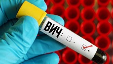 В Узбекистане более 41 тыс. человек живут с ВИЧ-инфекцией